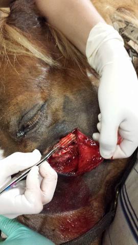 Wound Treatment